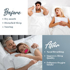 Gentle Sleep Pink Mouth Tapes